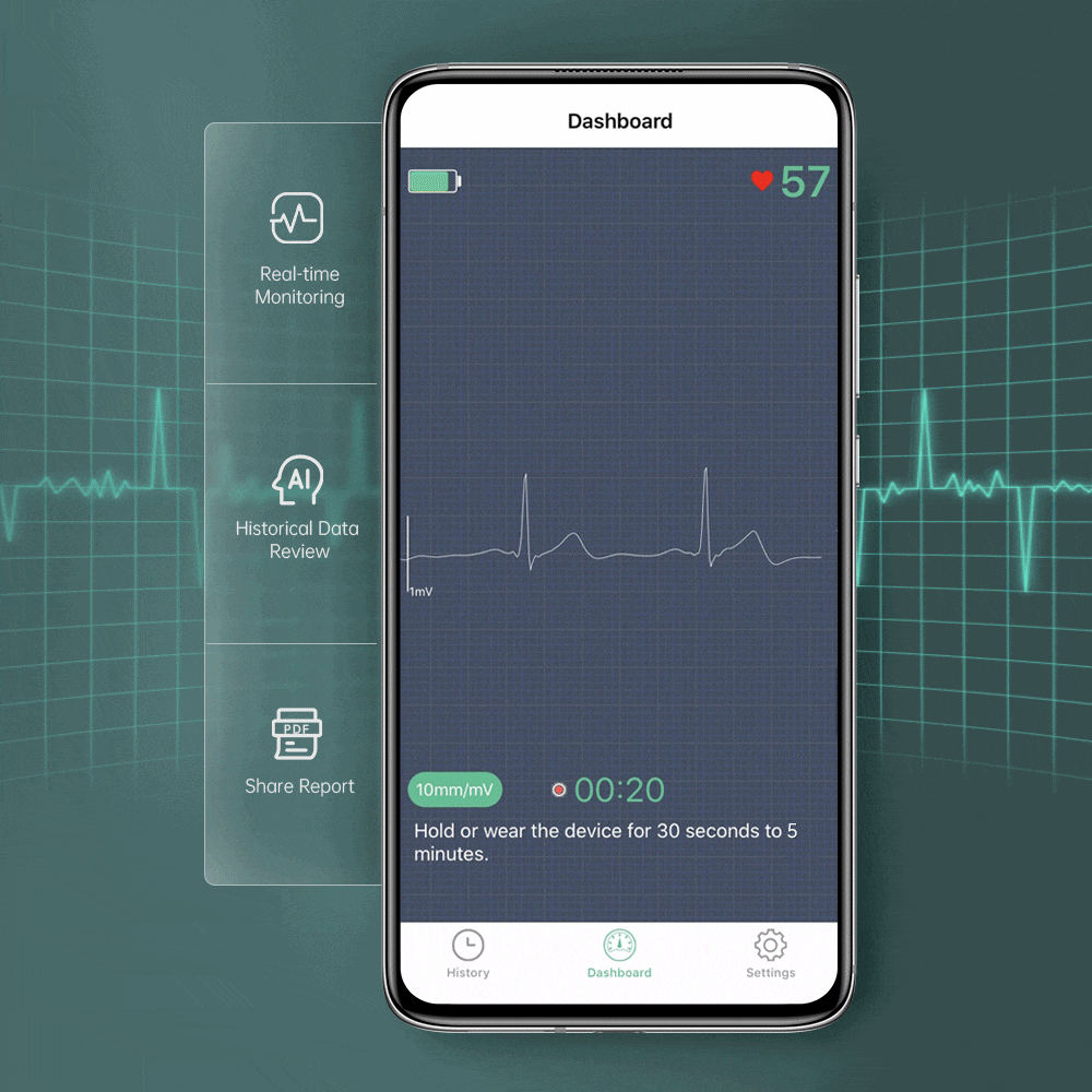 Portable EKG Monitor With OLED Screen- Take An Instant ECG/EKG Between ...